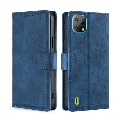 For Blackview A55 Skin Feel Crocodile Magnetic Clasp Leather Phone Case(Blue) - More Brand by buy2fix | Online Shopping UK | buy2fix